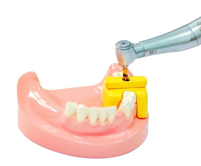 The template is placed over the gum to help dentists precisely perform implant surgery.